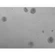 Day 21; Human cortical spheroids