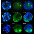 Immunostaining of the co-culture spheroids with the stellate cell markers (Vimentin and Smooth Muscle Actin) and the endothelial cell marker Von Willebrand Factor.