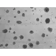 Days 10; 3D Rat Blood Brain Barrier Spheroids (At 100X magnification).
