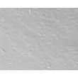Bovine Lens Epithelial Cells (BLEpiC)-Relief Contrast, 200X