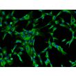 Bovine Lens Epithelial Cells (BLEpiC)-Immunostaining for CK-18, 200X.