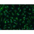 Bovine Iris Pigment Epithelial Cells (BIPEpiC)-Immunostaining for CK-18, 200X