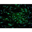 小鼠骨髓巨噬细胞（MMa-bm）- CD11b免疫染色，200倍放大。