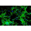 小鼠心脏成纤维细胞（MCF）- 纤维连接蛋白（Fibronectin）免疫染色，200×。