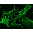 小鼠肝星状细胞（MHSteC）α-SMA 免疫染色，200×
