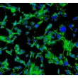 小鼠神经束膜成纤维细胞（MPNF）— 纤维连接蛋白（Fibronectin）免疫染色，200×放大。