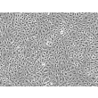 Human Adipose Microvascular Endothelial Cells (HAMEC) - Phase contrast, 100x.