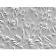 Human Adrenal Microvascular Endothelial Cells (HAdMEC) – Relief Contrast, 200x.
