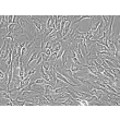 Human Adrenal Microvascular Endothelial Cells (HAdMEC) - Phase Contrast, 200x.
