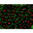 Human Adrenal Microvascular Endothelial Cells (HAdMEC) – Immunostaining for CD31, 400x.
