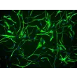 Human Astrocytes-hippocampal (HA-h) - Immunostaining for GFAP, 200x.
