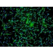Human Astrocytes-midbrain (HA-mb) - Immunostaining for GFAP, 100x.

