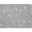 Human Bladder Microvascular Endothelial Cells (HBdMEC) - Phase contrast, 200x.
