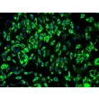 Human Bladder Microvascular Endothelial Cells (HBdMEC) - Immunostaining for vWF, 200x.
