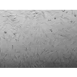 Human Bladder Smooth Muscle Cells (HBdSMC) - Relief contrast, 200x.
