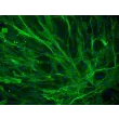 Human Bladder Smooth Muscle Cells (HBdSMC) - Immunostaining for α-SMA, 200x.

