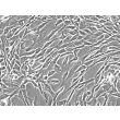 Human Bladder Stromal Fibroblasts (HBdSF) - Phase contrast, 200x.
