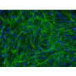 Human Bladder Stromal Fibroblasts (HBdSF) - Immunostaining for Fibronectin, 200x.
