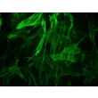 Human Brain Vascular Smooth Muscle Cells [HBVSMC] - Immunostaining for α-SMA, 400x.