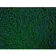 Human Bronchial Fibroblasts (HBF) - Immunostaining for Fibronectin, 100x.
