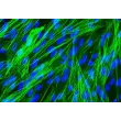 Human Bronchial Smooth Muscle Cells (HBSM) - Immunostaining for .
