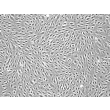 Human Cervical Microvascular Endothelial Cells (HCerMEC)-Phase Contrast, 100x
