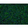Human Cervical Microvascular Endothelial Cells (HCerMEC)-Immunostaining for vWF, 200x
