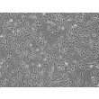 Human Choroid Plexus Fibroblasts (HCPF) - Phase contrast, 100x.
