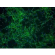 Human Choroid Plexus Fibroblasts (HCPF) - Immunostaining for Fibronectin, 100x.
