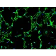 Human Colonic Fibroblasts (HCoF) – Immunostaining for Fibronectin, 200x
