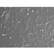 Human Colonic Fibroblasts (HCoF)- Relief Contrast, 200x
