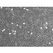 Human Colonic Fibroblasts (HCoF)- Phase Contrast, 100x
