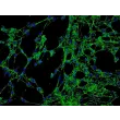 Human Conjunctival Fibroblasts (HConF) - Immunostaining for Fibronectin, 200x.
