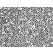 Human Corneal Epithelial Cells (HCEpiC) - Phase contrast, 100x.
