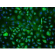Human Corneal Epithelial Cells (HCEpiC) - Immunostaining for CK-18, 200x.
