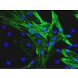 Human Coronary Artery Smooth Muscle Cells (HCASMC)-Immunostaining for α-SMA, 400x