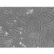 Human Dermal Fibroblasts-Fetal-Mitomycin C treated (HDF-f-mt) - Phase contrast, 200x.
