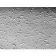 Human Dermal Fibroblasts-neonate (HDF-n) - Relief contrast, 200x.

