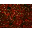 Human Dermal Lymphatic Endothelial Cells (HDLEC) – Immunostaining for Podoplanin, 100x.
