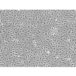 Human Dermal Microvascular Endothelial Cells-adult (HDMEC-a) - Phase contrast, 100x.
