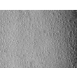 Human Dermal Microvascular Endothelial Cells-adult (HDMEC-a) - Relief contrast, 100x.
