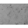 Human Epidermal Melanocytes-dark (HEM-d) - Relief contrast, 400x.
