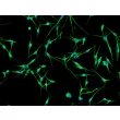 Human Epidermal Melanocytes-dark (HEM-d) - Immunostaining for Vimentin, 200x.
