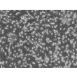Human Epidermal Melanocytes-medium (HEM-m) - Phase contrast, 100x.

