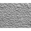Human Esophageal Epithelial Cells (HEEpiC) - Relief contrast, 200x.
