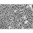 Human Esophageal Epithelial Cells (HEEpiC) - Phase contrast, 200x.
