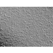 Human Esophageal Smooth Muscle Cells (HESMC) - Relief contrast, 100x.
