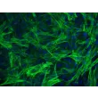 Human Esophageal Smooth Muscle Cells (HESMC) - Immunostaining for α-SMA, 200x.
