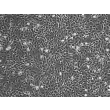 Human Gastric Fibroblasts (HGF)-Phase Contrast, 100x.
