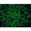 Human Hair Germinal Matrix Cells (HHGMC) - Immunostaining for Fibronectin, 200x.
